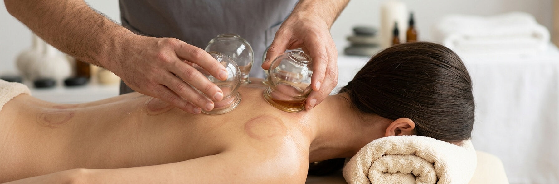 Cupping Therapy - Supplies, Equipment, Techiques, Safety Protocols