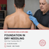 Trigger Point Dry Needling (IMS)